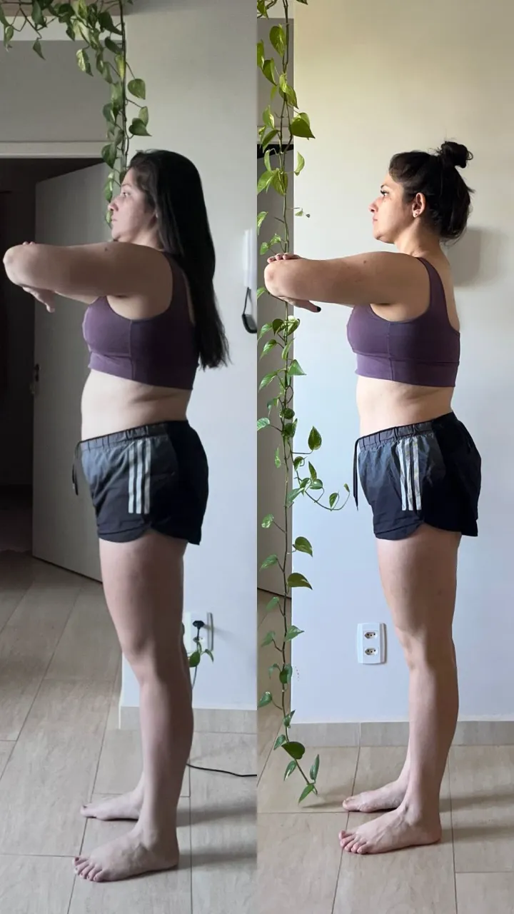 Antes e depois de aluna, vista lateral, com ganho de definição